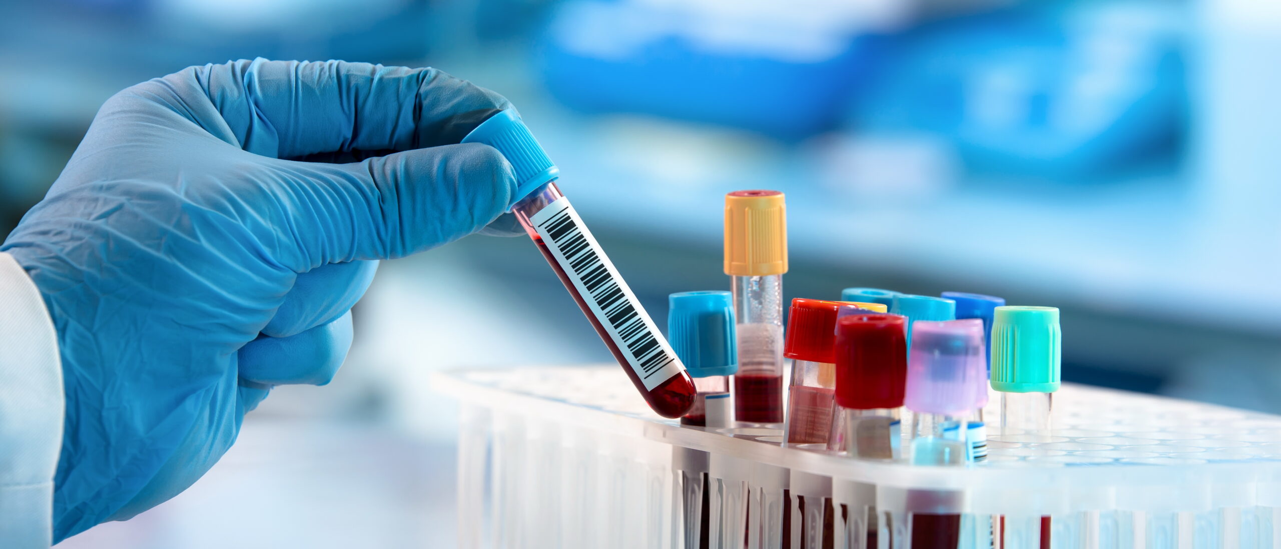 PCR Koronavirüs Testi